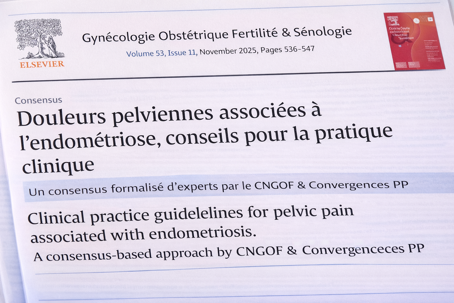 Article de douleurs pelviennes associées à l'endométriose
